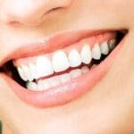 Woman Showing Her Bright Smile Teeth Whitening