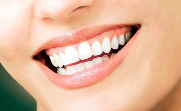 Woman Showing Her Bright Smile Teeth Whitening