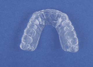 Dental Mouthguard For Protection - Trade Winds Dental