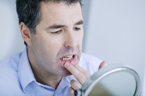 Man With Irritated Gums - Trade Winds Dental