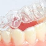 Invisalign - Trade Winds Dental