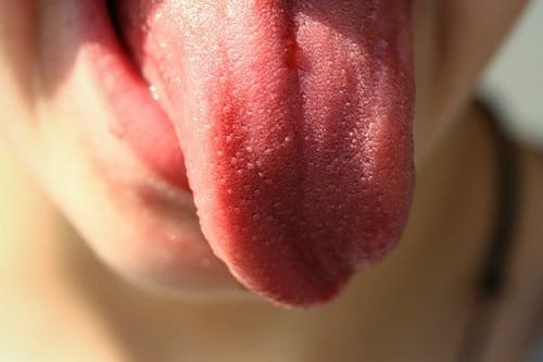 Person With Tongue Out - Trade Winds Dental