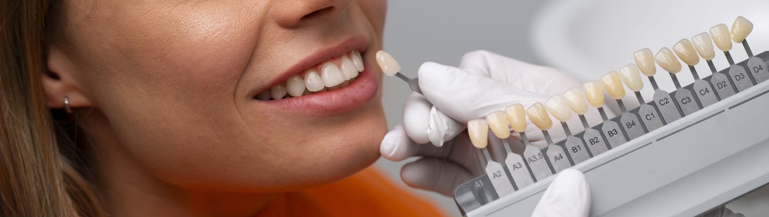 Dentist holds up veneer samples to women's teeth