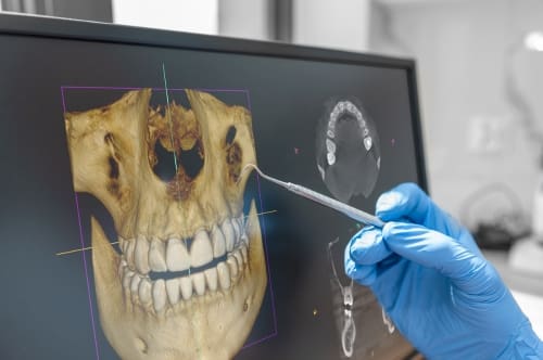 Dentist Looks Over 3D Dental CBCT Digital X-ray Scan