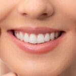 Teeth Deep Cleaning in Georgetown, TX - Trade Winds Dental